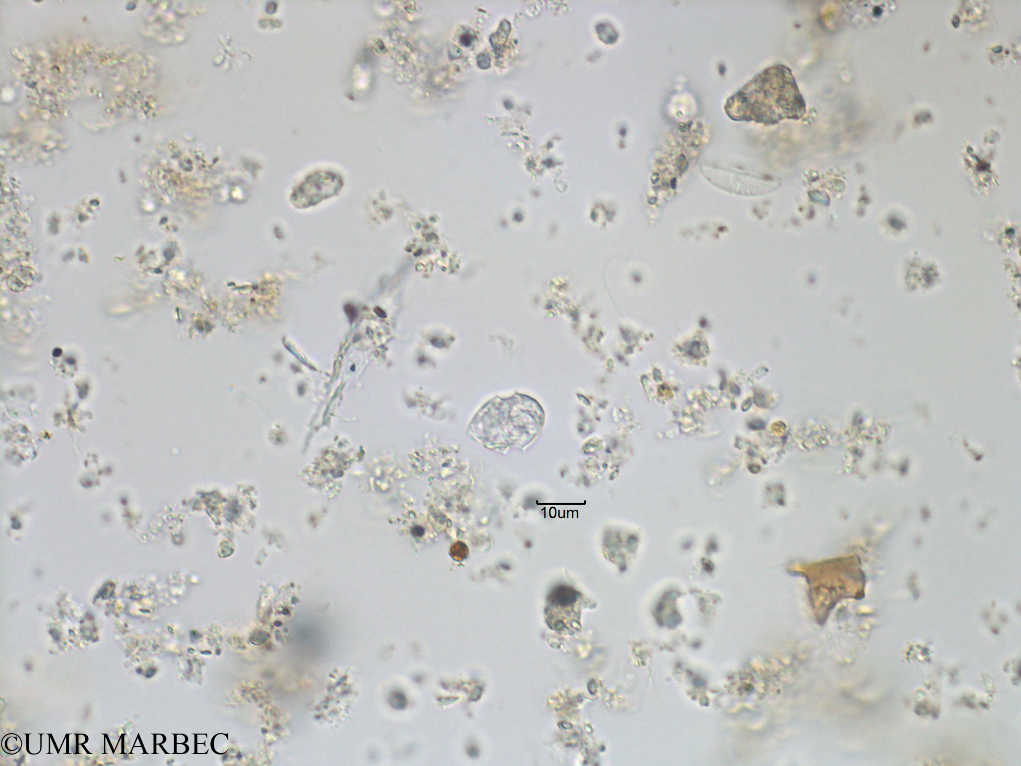 phyto/Bizerte/bizerte_bay/RISCO November 2015/Scrippsiella spp (Baie_T1C-cf scrippsiella).tif(copy).jpg
